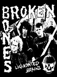 Broken Bones - Poster